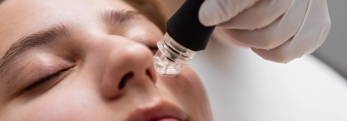 microneedling Norrköping