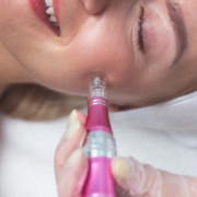 microneedling norrköping